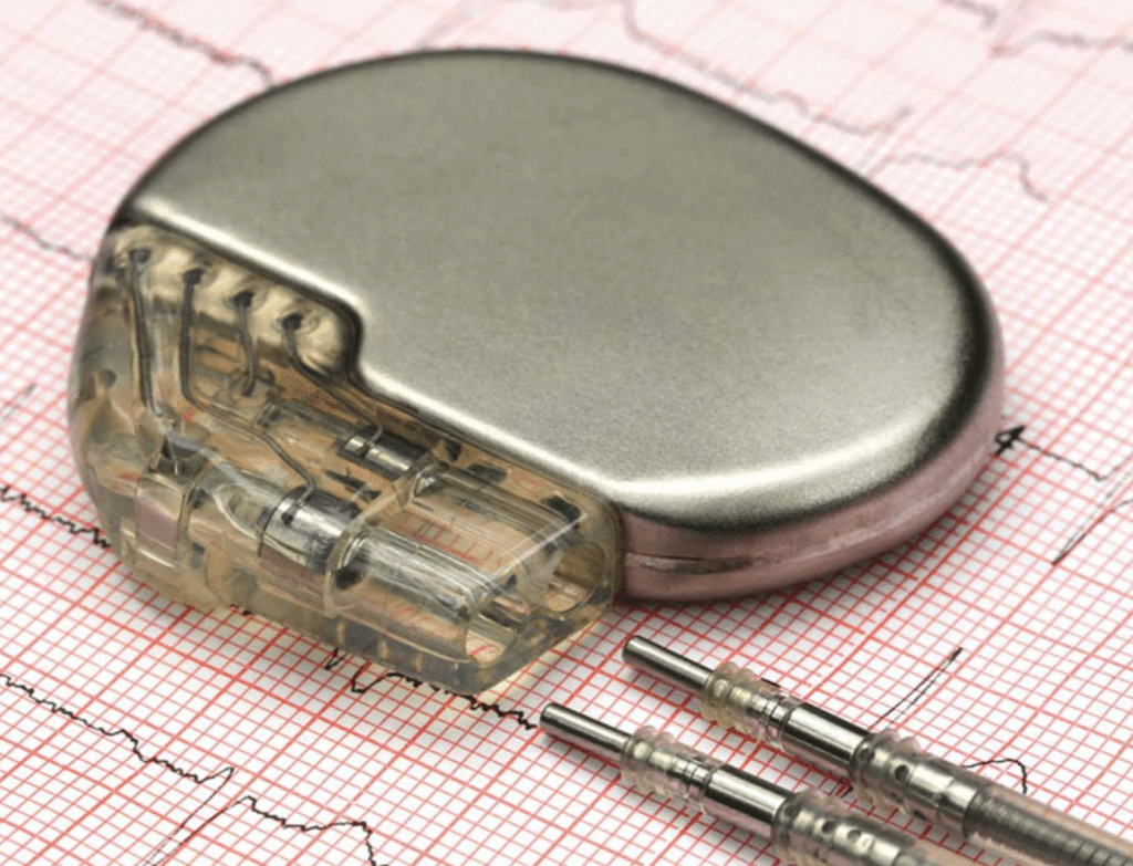 An implantable pacemaker sat on ECG paper with cardiogram results printed on it