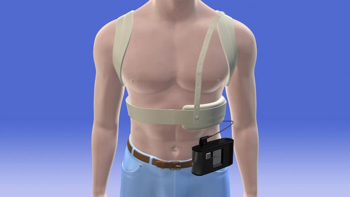 A human wearing a wearable cardioverter defibrillator vest